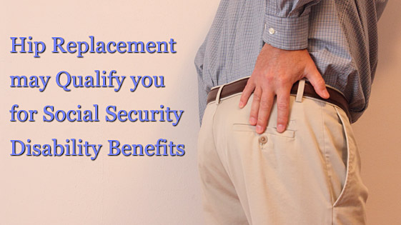 hip replacement disability lawyer
