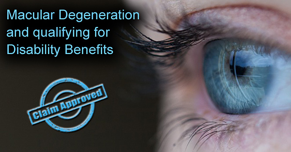 Macular Degeneration and qualifying for Disability Benefits