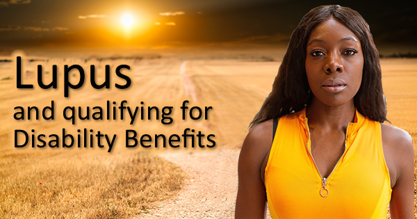 Lupus and qualifying for Social Security Disability Insurance